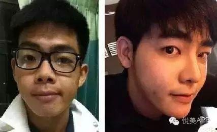 男网红整容脸吃瓜图片,吃瓜群众热议男网红变脸之谜