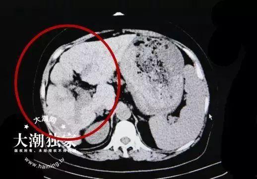 ccgg.ct吃瓜网,揭秘娱乐圈幕后故事，带你领略真实娱乐圈