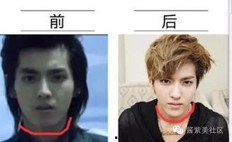 男网红整容脸吃瓜视频,吃瓜群众热议的整形真相