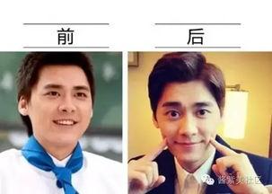 男网红整容脸吃瓜视频,吃瓜群众热议的整形真相